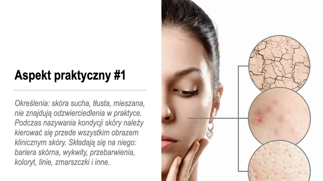 Kobieta z problemami skórnymi: sucha, popękana, z wypryskami i rozszerzonymi porami. To mogą być zaburzenia hormonalne objawy.