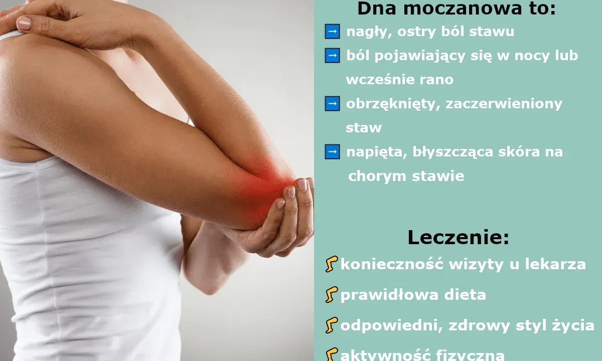 Dna moczanowa: objawy skórne, ból stawu, obrzęk. Leczenie: wizyta u lekarza, dieta, styl życia, aktywność fizyczna.