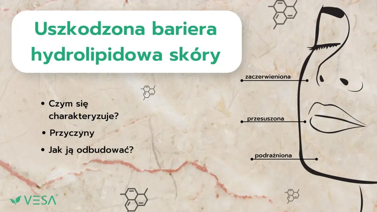 Uszkodzona bariera hydrolipidowa skóry: zaczerwieniona, przesuszona, podrażniona. Jak odbudować naskórek?