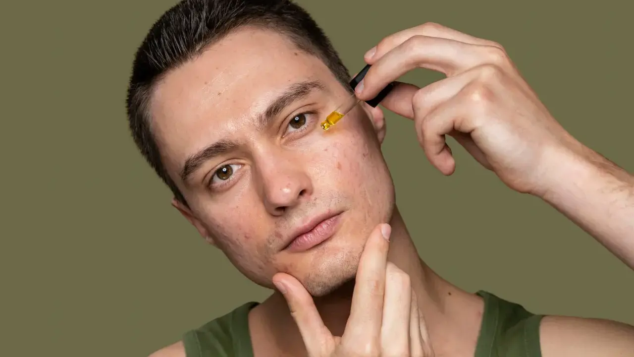 Mężczyzna z problematyczną cerą aplikuje serum. Zamiast wyciskanie wągrów, stawia na pielęgnację.
