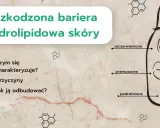 Uszkodzona bariera hydrolipidowa skóry: zaczerwieniona, przesuszona, podrażniona. Jak odbudować naskórek?