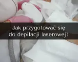 Depilacja laserowa: Twój kalendarz przygotowań do idealnej skóry.
