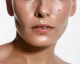 Błyszcząca skóra z widocznym **sebum** na policzkach i nosie, podkreślająca naturalne piękno.