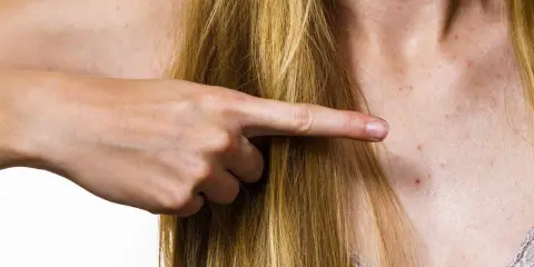 Pryszcze na dekolcie? Jak skutecznie się ich pozbyć poradnik