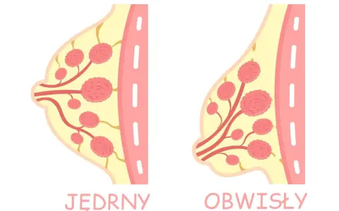 Ilustracja porównuje jędrne i obwisłe piersi, pokazując różnice w ich budowie.