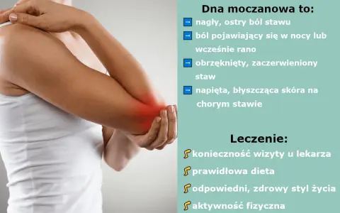 Dna moczanowa: objawy skórne, ból stawu, obrzęk. Leczenie: wizyta u lekarza, dieta, styl życia, aktywność fizyczna.