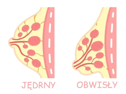 Ilustracja porównuje jędrne i obwisłe piersi, pokazując różnice w ich budowie.