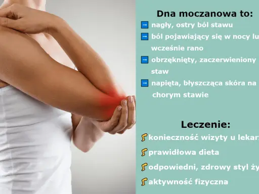 Dna moczanowa: objawy skórne, ból stawu, obrzęk. Leczenie: wizyta u lekarza, dieta, styl życia, aktywność fizyczna.