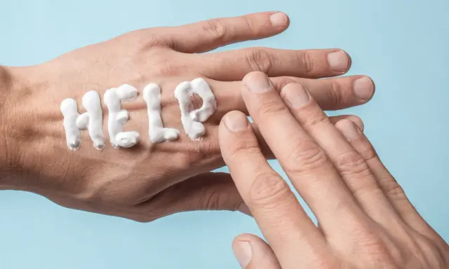 Krem do rąk w kształcie napisu "HELP" na skórze. Jak odmłodzić dłonie? Czas na pielęgnację!