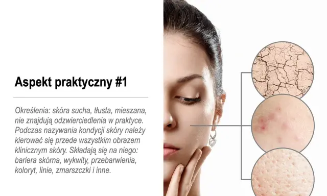 Kobieta z problemami skórnymi: sucha, popękana, z wypryskami i rozszerzonymi porami. To mogą być zaburzenia hormonalne objawy.