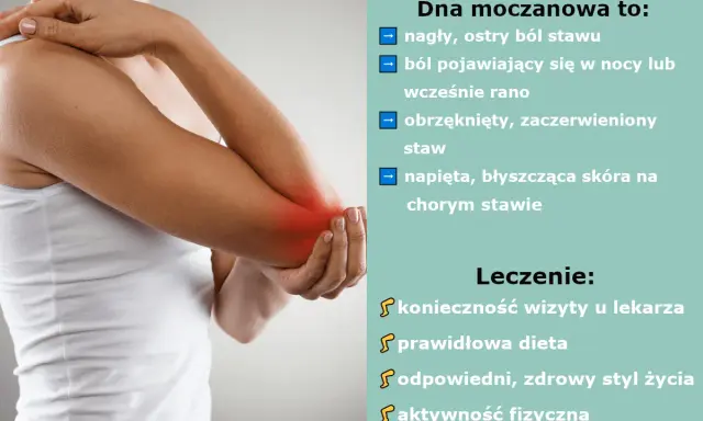 Dna moczanowa: objawy skórne, ból stawu, obrzęk. Leczenie: wizyta u lekarza, dieta, styl życia, aktywność fizyczna.
