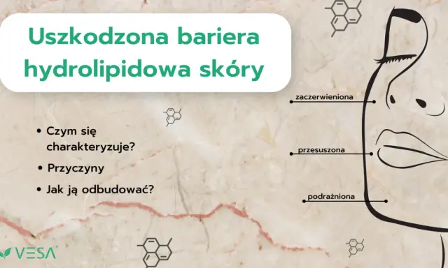 Uszkodzona bariera hydrolipidowa skóry: zaczerwieniona, przesuszona, podrażniona. Jak odbudować naskórek?