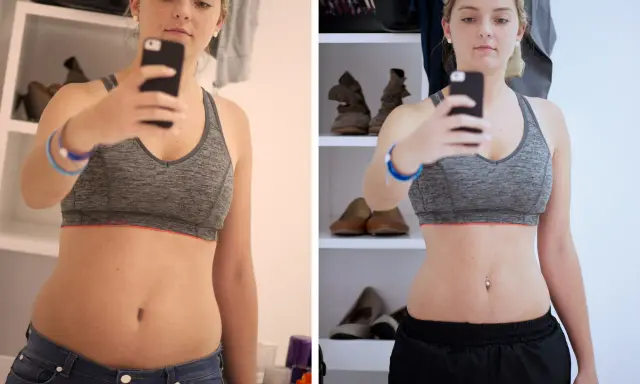 Kobieta robi selfie, porównując sylwetkę przed i po zabiegu sonoforezy. Widać różnicę w talii.