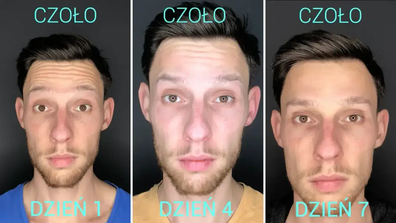 Lekarz medycyny estetycznej analizujący anatomię twarzy pacjenta przed zabiegiem
