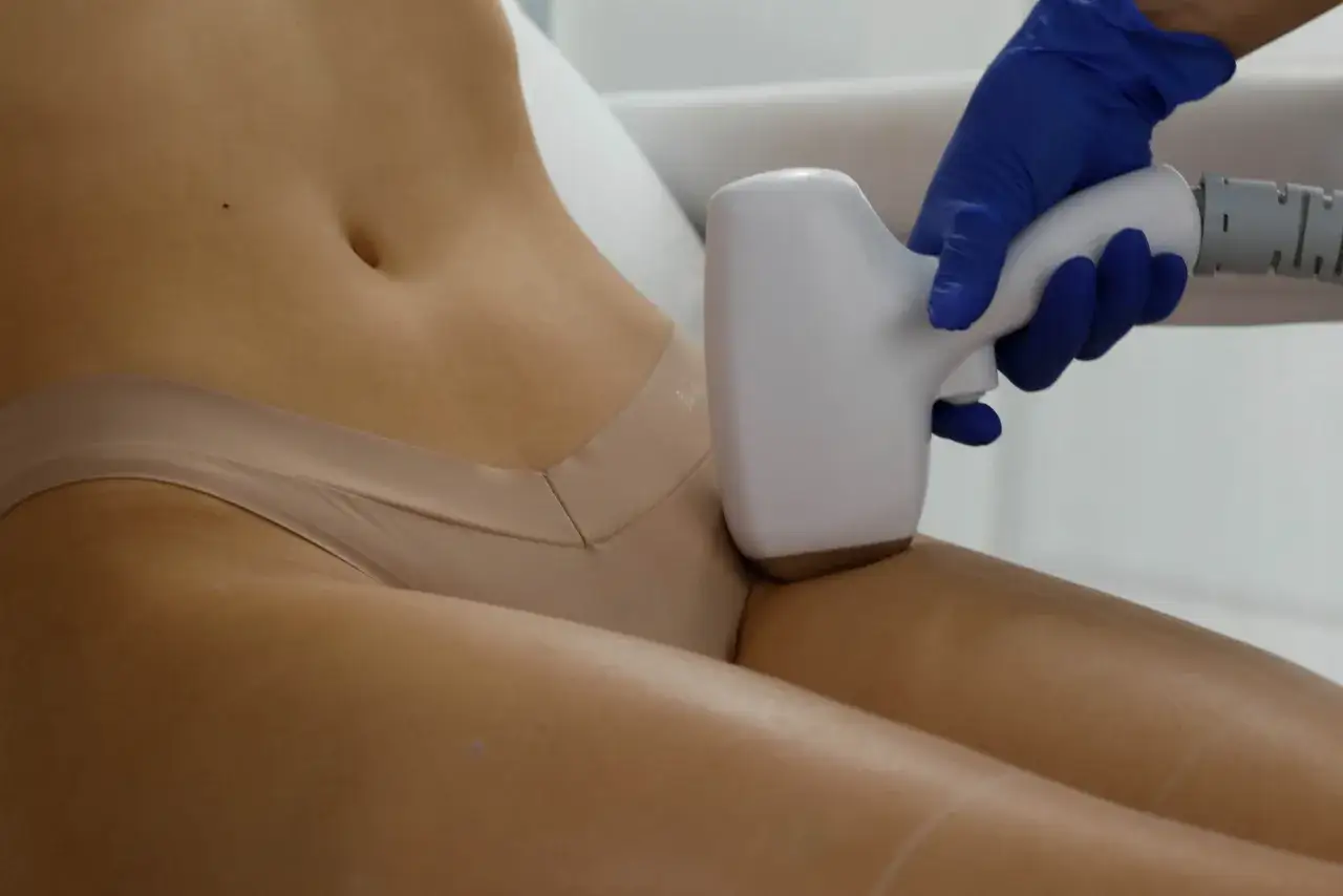 Rodzaje depilacji bikini grafika porównawcza